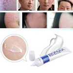 Crema Bioaqua Puntos Negros Anti Acne Cicatrices Poros