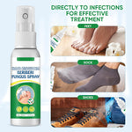 Micostop Terapéutico Herbal Spray antifúngico natural para hongos en pies, manos y articulaciones